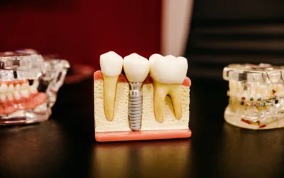 Does Medicare cover Dental Implants?